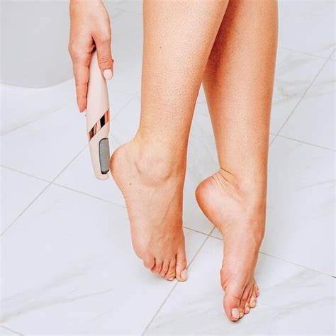 ELECTA™ - Removedor de callos Eléctrico