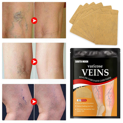 VARIPATCH™ – Parches para Varices