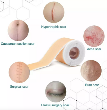 SCARFIX™ – Parche Cicatrizante