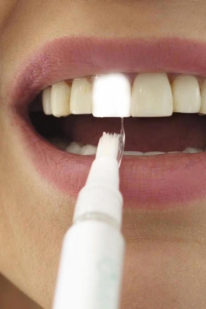 SMILEPIN™ – Lápiz Blanqueador Dental