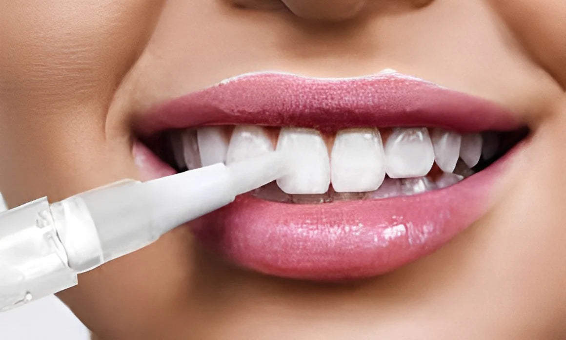 SMILEPIN™ – Lápiz Blanqueador Dental